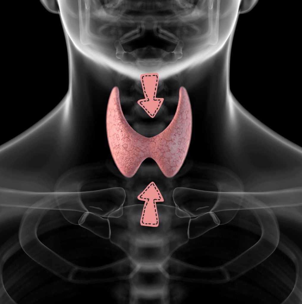 An x-ray picture with a thyroid gland and 2 arrows